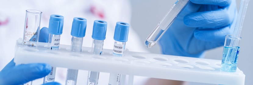 工業用甲醇檢測