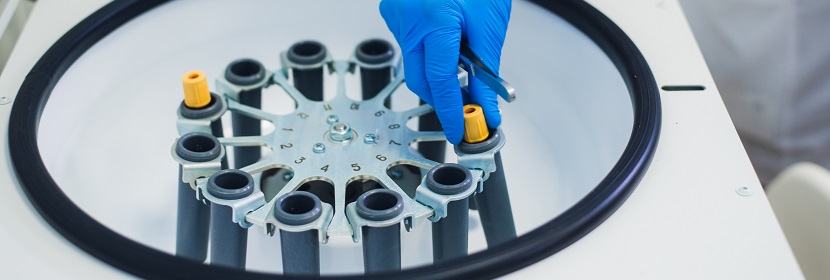 工業(yè)堿式碳酸鋅檢測(cè)